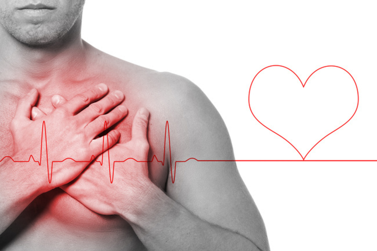 ¿Cómo hacer para prevenir un infarto?